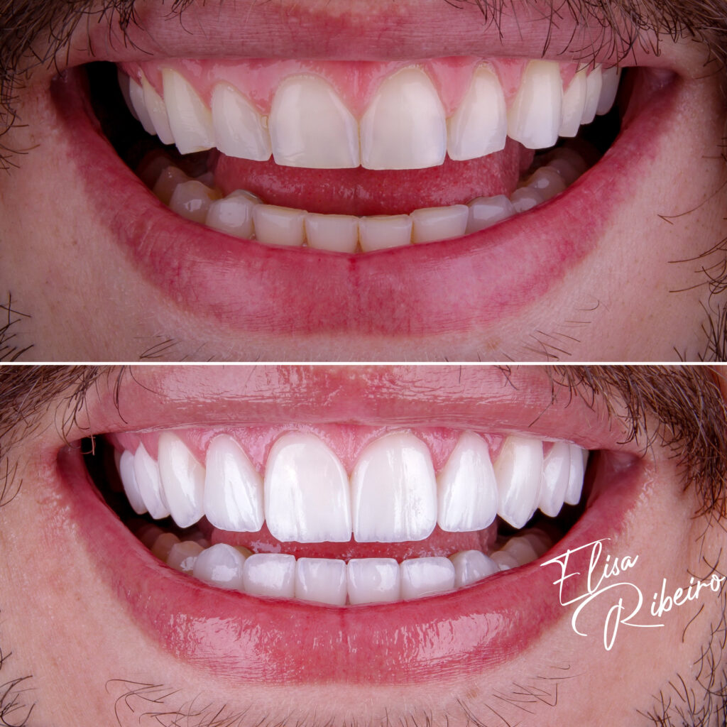 6152BCE5-93D8-4198-B647-24B9C97B1385